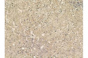 ABIN6256818 and ABIN6267197 at 1/100 staining human normal liver tissue by IHC-P. (TEK 抗体  (pTyr992))