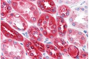 Human Kidney: Formalin-Fixed, Paraffin-Embedded (FFPE) (CPVL 抗体  (AA 1-477))