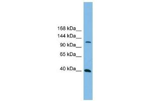 MAP3K14 antibody used at 1 ug/ml to detect target protein. (MAP3K14 抗体  (N-Term))