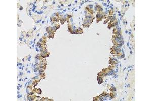 Immunohistochemistry of paraffin-embedded Mouse lung using B9D1 Polyclonal Antibody at dilution of 1:100 (40x lens). (B9D1 抗体)