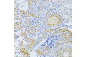 Immunohistochemistry of paraffin-embedded rat ovary using CYCS antibody.