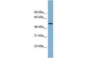 Human 721_B; WB Suggested Anti-ACTR3B Antibody Titration: 0. (ACTR3B 抗体  (N-Term))