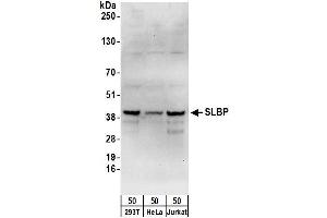 anti-Stem-Loop Binding Protein (SLBP) (AA 220-270) antibody