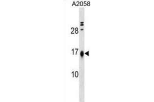 Western Blotting (WB) image for anti-Limb-Bud and Heart (LBH) antibody (ABIN5019448) (LBH 抗体)