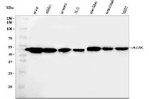 Western blot analysis of ADK using anti-ADK antibody (ABIN4886430). (ADK 抗体  (AA 165-351))