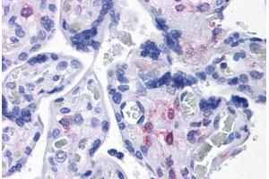 Human Placenta: Formalin-Fixed, Paraffin-Embedded (FFPE) (PLAC1 抗体  (C-Term))