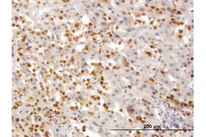 Immunoperoxidase of monoclonal antibody to TARS on formalin-fixed paraffin-embedded human liver. (TARS 抗体  (AA 44-143))