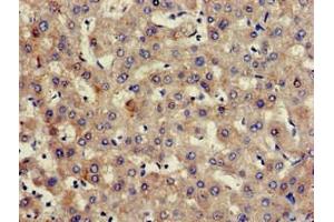 Immunohistochemistry of paraffin-embedded human liver tissue using ABIN7154998 at dilution of 1:100 (Hemopexin 抗体  (AA 32-254))