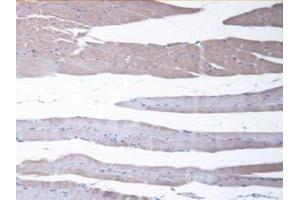 IHC-P analysis of Mouse Skeletal Muscle Tissue, with DAB staining. (CBR1 抗体  (AA 66-271))