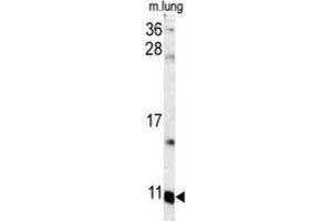 Western Blotting (WB) image for anti-S100 Calcium Binding Protein A6 (S100A6) antibody (ABIN3003159) (S100A6 抗体)