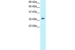 WB Suggested Anti-NR2F6 Antibody   Titration: 0. (NR2F6 抗体  (N-Term))