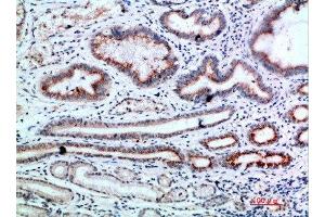 Immunohistochemistry (IHC) image for anti-L1 Cell Adhesion Molecule (L1CAM) (AA 151-200) antibody (ABIN7189451)