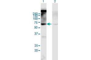 Western Blot analysis of CHRM2 expression in transfected 293T cell line by CHRM2 MaxPab polyclonal antibody. (Muscarinic Acetylcholine Receptor M2 抗体  (AA 1-466))