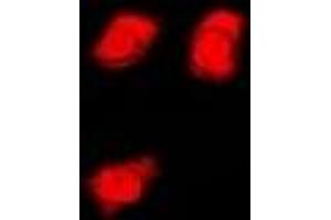 Immunofluorescent analysis of FMR1 staining in U2OS cells. (FMR1 抗体)