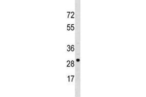 Western Blotting (WB) image for anti-Voltage-Dependent Anion Channel 3 (VDAC3) (AA 156-183) antibody (ABIN3029604)