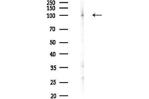 Western blot analysis of lysates from Rat lung, using Integrin beta3 Antibody at 1/1000 dilution.