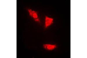 Immunofluorescent analysis of p53 (pS15) staining in PC12 cells. (p53 抗体  (N-Term, pSer15))