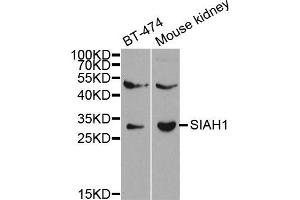 Western Blotting (WB) image for anti-E3 Ubiquitin-Protein Ligase SIAH1 (SIAH1) antibody (ABIN1874778) (SIAH1 抗体)