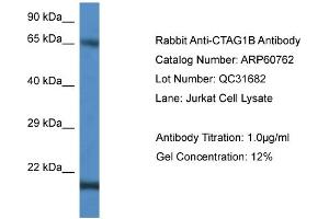 Western Blotting (WB) image for anti-Cancer/testis Antigen 1B (CTAG1B) (C-Term) antibody (ABIN786263) (CTAG1B 抗体  (C-Term))