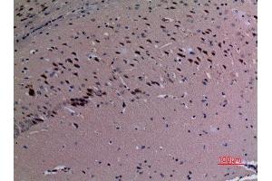 Immunohistochemistry (IHC) analysis of paraffin-embedded Mouse Brain, antibody was diluted at 1:100. (SND1 抗体  (Internal Region))