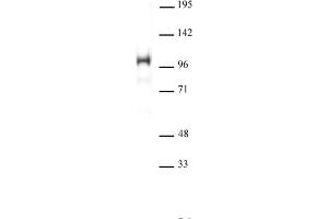 SATB1 antibody (pAb) tested by Western blot. (SATB1 抗体  (N-Term))