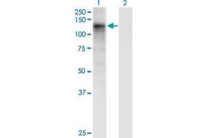 Western Blot analysis of DSE expression in transfected 293T cell line by DSE monoclonal antibody (M03), clone 6D4. (DSE 抗体  (AA 574-673))