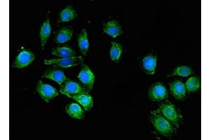 Immunofluorescent analysis of A549 cells using ABIN7174662 at dilution of 1:100 and Alexa Fluor 488-congugated AffiniPure Goat Anti-Rabbit IgG(H+L) (UAP1 抗体  (AA 1-522))