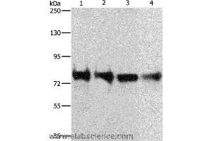 Western blot analysis of 293T, hela, Jurkat and Lovo cell, using CDH6 Polyclonal Antibody at dilution of 1:300 (CDH6 抗体)