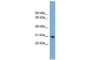 FCN1 antibody used at 0. (FCN1 抗体  (Middle Region))
