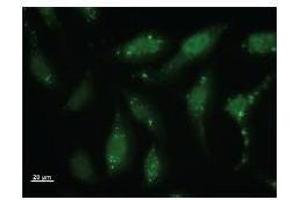 Immunostaining analysis in HeLa cells. (Id2 抗体)