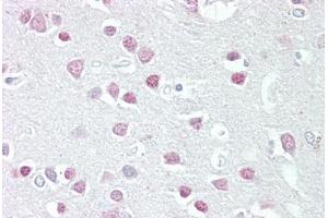 Anti-MC5 Receptor antibody IHC staining of human brain, cortex. (MC5 Receptor 抗体  (AA 24-35))