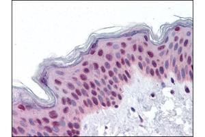 Human Skin: Formalin-Fixed, Paraffin-Embedded (FFPE) (RUVBL2 抗体  (Ser129))