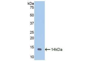Detection of Recombinant MTNR1A, Caprine using Polyclonal Antibody to Melatonin Receptor 1A (MTNR1A) (Melatonin Receptor 1A 抗体  (AA 312-366))