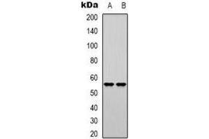 Western blot analysis of DNA Polymerase mu expression in K562 (A), Jurkat (B) whole cell lysates. (POLM 抗体)