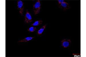 Confocal microscopy image of Proximity Ligation Assay of protein-protein interactions between HDAC2 and STAT3. (HDAC2 & STAT3 Protein Protein Interaction Antibody Pair)