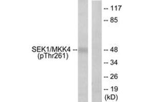 Western blot analysis of extracts from 293 cells treated with UV 15', using SEK1/MKK4 (Phospho-Thr261) Antibody. (MAP2K4 抗体  (pThr261))