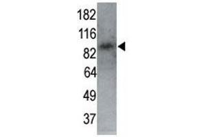 MARK1 antibody used in western blot to detect MARK1 in P7 mouse whole brain lysate (60 ug) at 1:250. (MARK1 抗体  (AA 6-40))