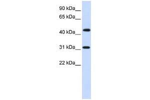 WB Suggested Anti-ZNF684 Antibody Titration:  0. (ZNF684 抗体  (N-Term))