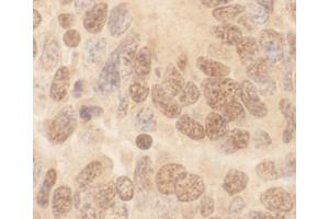 Immunohistochemistry (IHC) image for anti-Cullin 2 (CUL2) (AA 150-200) antibody (ABIN7448503) (Cullin 2 抗体  (AA 150-200))