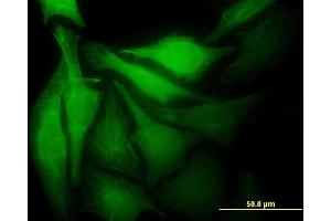Immunofluorescence of monoclonal antibody to MAD2L1BP on HeLa cell. (MAD2L1BP 抗体  (AA 1-274))