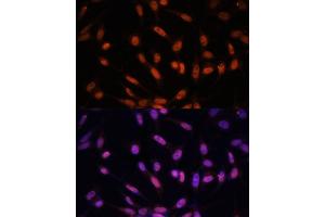Immunofluorescence analysis of NIH/3T3 cells using Twist antibody (ABIN6128846, ABIN6149715, ABIN6149718 and ABIN6223153) at dilution of 1:100. (TWIST1 抗体  (AA 103-202))
