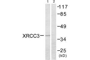 Western blot analysis of extracts from HepG2 cells, treated with Adriamycin (0. (XRCC3 抗体  (Internal Region))