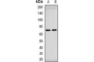 Western blot analysis of HAI-1 expression in mouse liver (A), rat brain (B) whole cell lysates. (SPINT1 抗体)