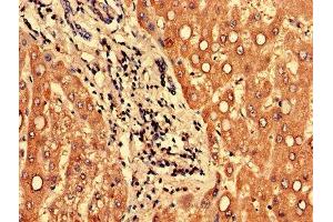 Immunohistochemistry (IHC) image for anti-Protein Phosphatase 1, Regulatory Subunit 3B (PPP1R3B) (AA 1-285), (Regulatory Subunit 3B) antibody (ABIN7165933)