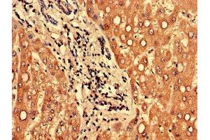 Immunohistochemistry of paraffin-embedded human liver tissue using ABIN7165933 at dilution of 1:100 (PPP1R3B 抗体  (Regulatory Subunit 3B))