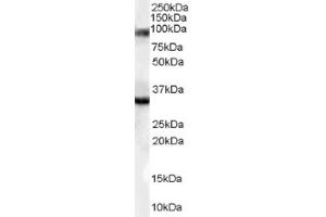 Image no. 1 for anti-LIM Domain Binding 3 (LDB3) (Internal Region) antibody (ABIN374603) (LIM Domain Binding 3 Protein 抗体  (Internal Region))