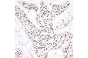 anti-Achaete-Scute Complex Homolog 2 (ASCL2) (AA 225-275) antibody