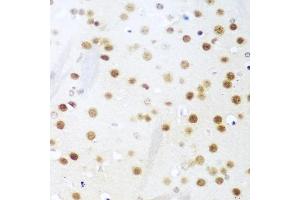 Immunohistochemistry of paraffin-embedded mouse brain using UNG antibody (ABIN6133476, ABIN6149934, ABIN6149936 and ABIN6216305) at dilution of 1:100 (40x lens). (UNG 抗体  (AA 1-313))