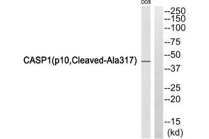 Western blot analysis of extracts from COS7 cells, using Caspase 1 (p10, Cleaved-Ala317) antibody. (Caspase 1 抗体  (Cleaved-Ala317))