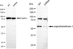 Western blotting analysis using arginyltransferase 1 antibody (ABIN7797649). (Recombinant ATE1 抗体)